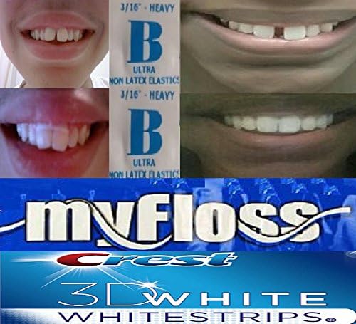 Ortodontske trake za zube za zube 3/16 teške s trakama za izbjeljivanje i flos